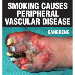 Azure Blonde - 100g - Alaskan Ice - Azure